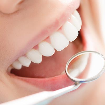 smiling white teeth